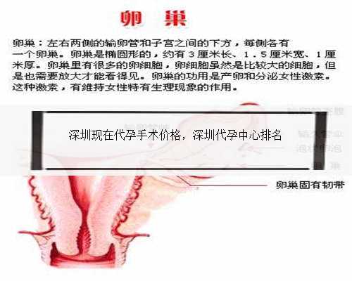 深圳现在代孕手术价格，深圳代孕中心排名