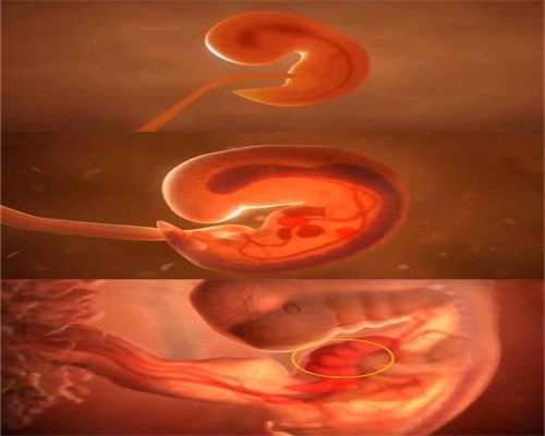 男性试管婴儿步骤：输卵管造影后出血疼痛