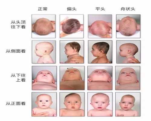 荆州试管婴儿查基因-荆州试管婴儿取卵到底多痛-评估试管重庆代孕婴儿成功几
