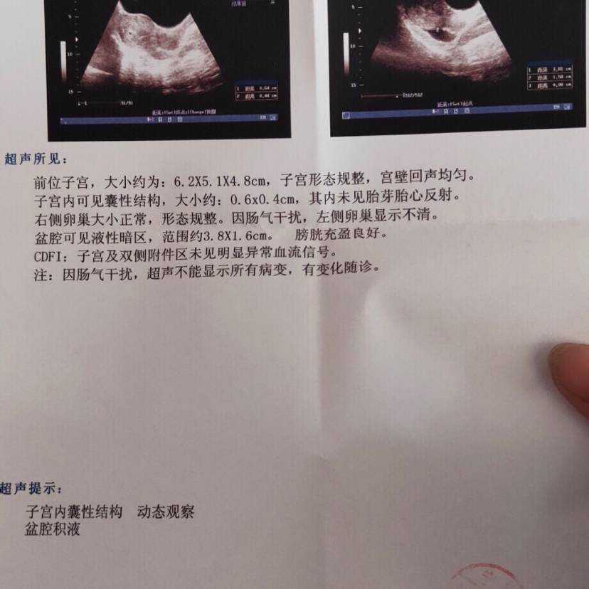 深圳三代供卵试管婴儿医院排名？附深圳试管成功率明细？