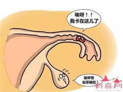 深圳试管代孕过程咨询，2022深圳第三代试管婴儿成功率？